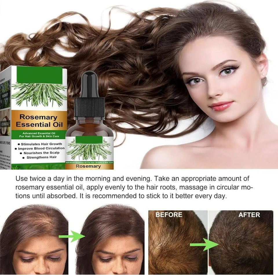 Rosemary Flourish Oil for Hair Growth 30ml My store